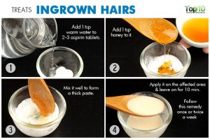 how to make a doctor note treats ingrown hairs