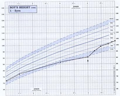 infant growth chart boy